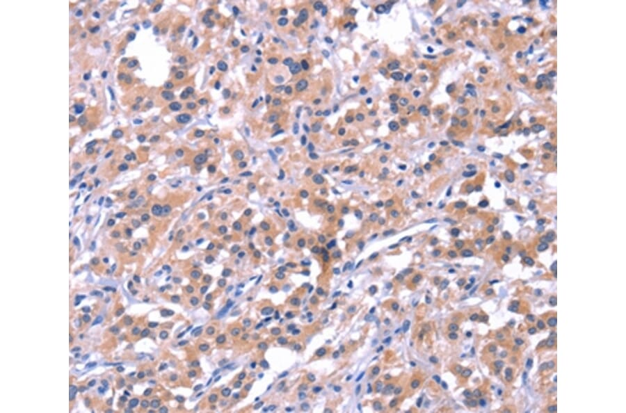 Immunohistochemistry - EP300 Antibody from Signalway Antibody (37550) - Antibodies.com