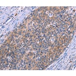 Immunohistochemistry - MSMO1 Antibody from Signalway Antibody (37553) - Antibodies.com