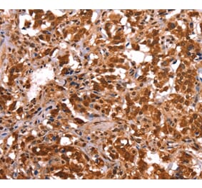 Immunohistochemistry - ESRRB Antibody from Signalway Antibody (37556) - Antibodies.com