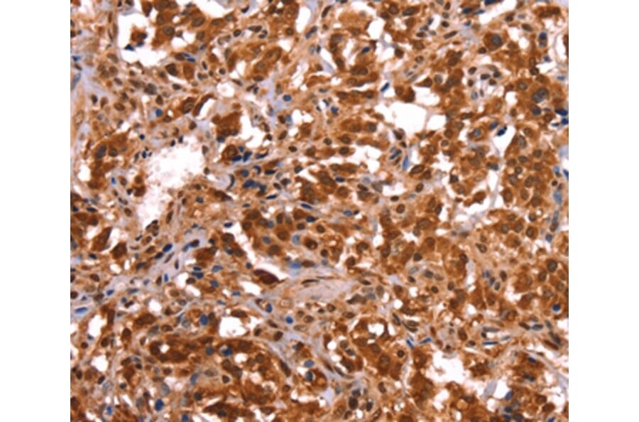 Immunohistochemistry - ESRRB Antibody from Signalway Antibody (37556) - Antibodies.com