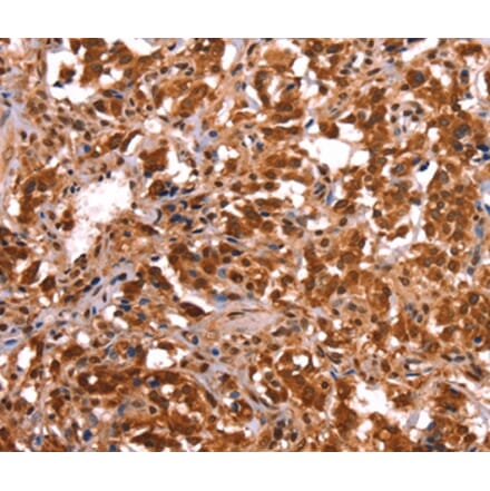 Immunohistochemistry - ESRRB Antibody from Signalway Antibody (37556) - Antibodies.com