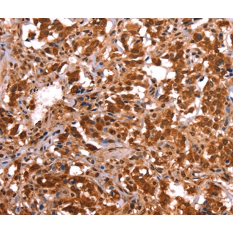 Immunohistochemistry - ESRRB Antibody from Signalway Antibody (37556) - Antibodies.com