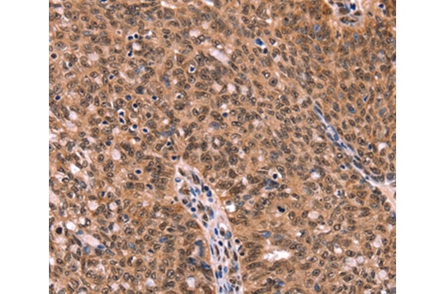Immunohistochemistry - ESRRB Antibody from Signalway Antibody (37556) - Antibodies.com