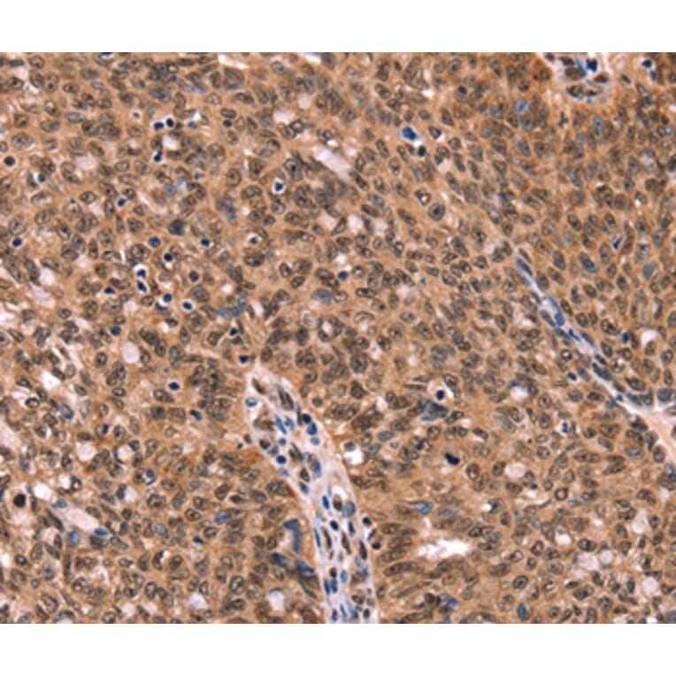 Immunohistochemistry - ESRRB Antibody from Signalway Antibody (37556) - Antibodies.com