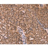 Immunohistochemistry - ESRRB Antibody from Signalway Antibody (37556) - Antibodies.com