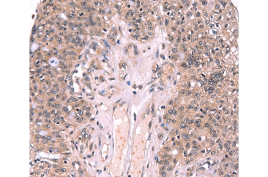 Immunohistochemistry - EXTL1 Antibody from Signalway Antibody (37561) - Antibodies.com