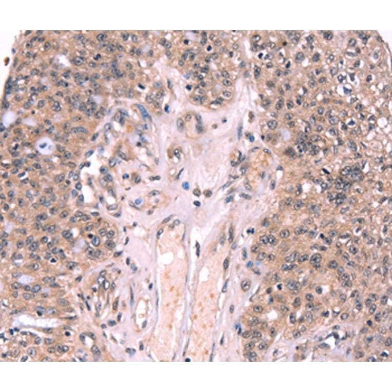 Immunohistochemistry - EXTL1 Antibody from Signalway Antibody (37561) - Antibodies.com