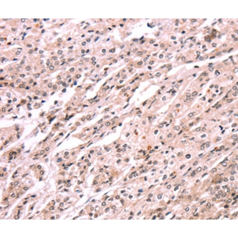 Immunohistochemistry - EXTL1 Antibody from Signalway Antibody (37561) - Antibodies.com