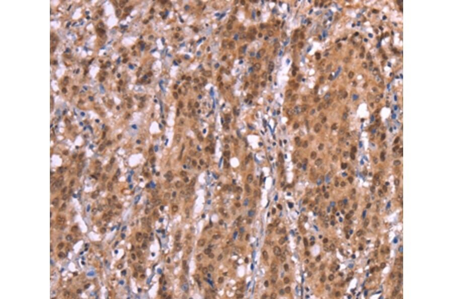 Immunohistochemistry - AMER1 Antibody from Signalway Antibody (37563) - Antibodies.com