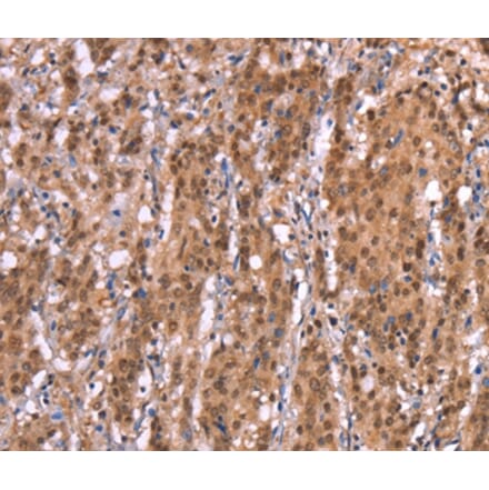 Immunohistochemistry - AMER1 Antibody from Signalway Antibody (37563) - Antibodies.com