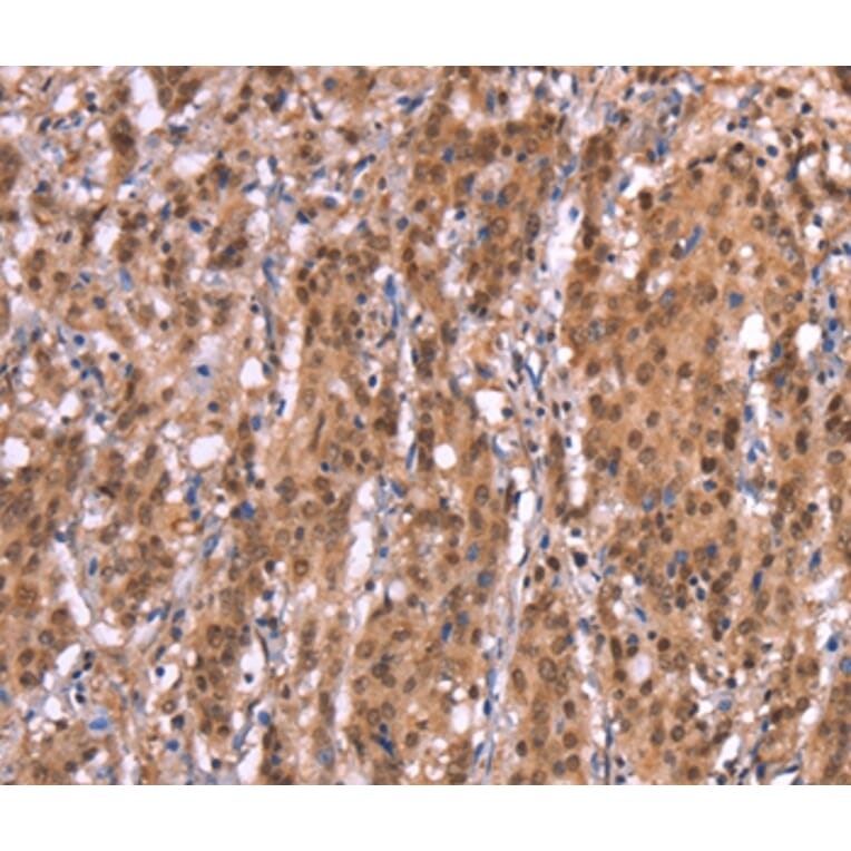 Immunohistochemistry - AMER1 Antibody from Signalway Antibody (37563) - Antibodies.com