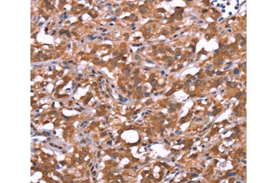 Immunohistochemistry - AMER1 Antibody from Signalway Antibody (37563) - Antibodies.com