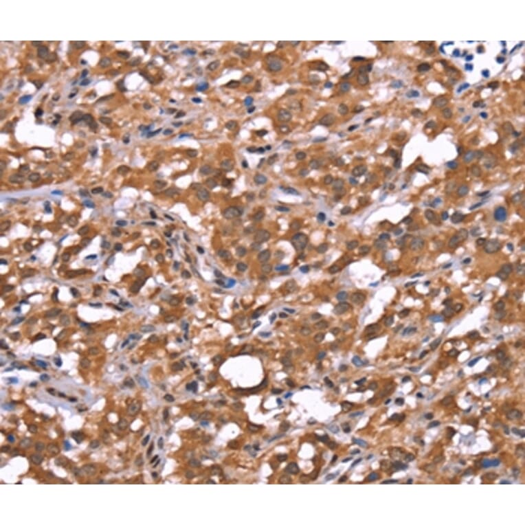 Immunohistochemistry - AMER1 Antibody from Signalway Antibody (37563) - Antibodies.com