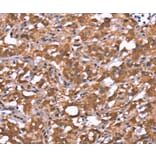 Immunohistochemistry - AMER1 Antibody from Signalway Antibody (37563) - Antibodies.com