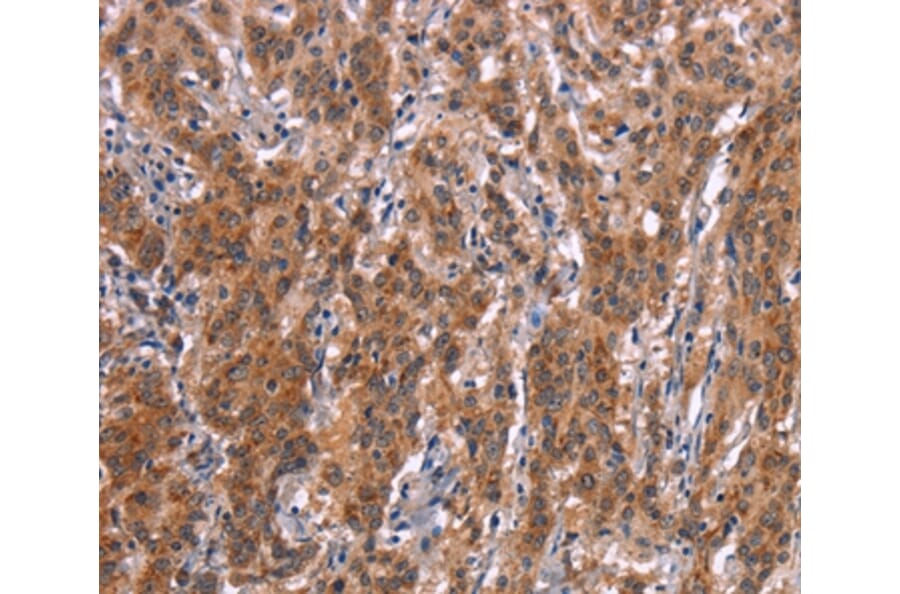Immunohistochemistry - FDCSP Antibody from Signalway Antibody (37568) - Antibodies.com