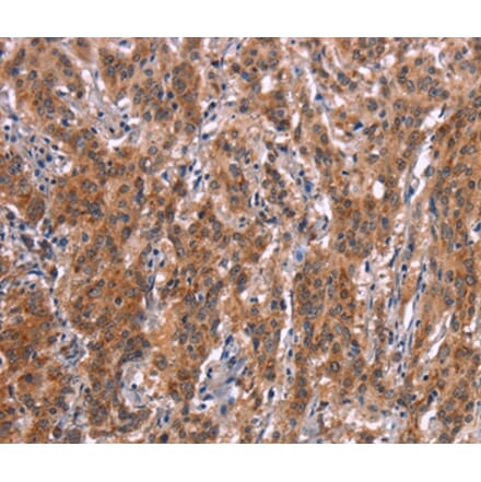 Immunohistochemistry - FDCSP Antibody from Signalway Antibody (37568) - Antibodies.com