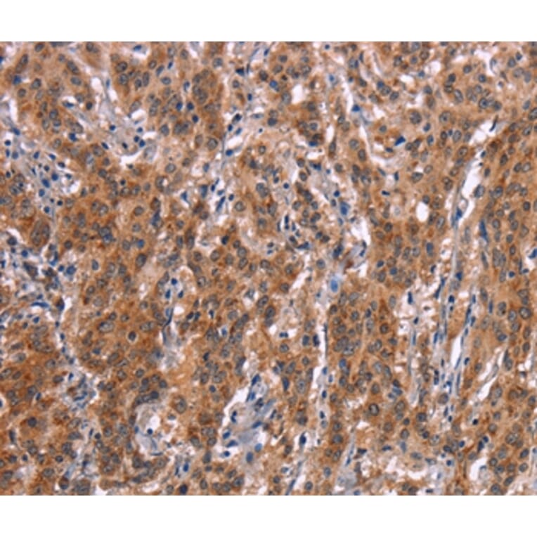 Immunohistochemistry - FDCSP Antibody from Signalway Antibody (37568) - Antibodies.com