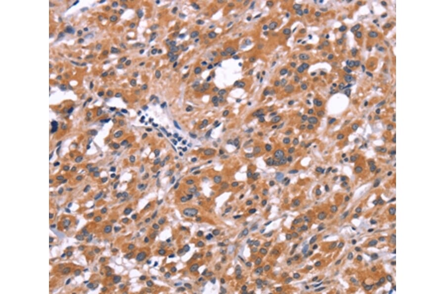 Immunohistochemistry - FDCSP Antibody from Signalway Antibody (37568) - Antibodies.com