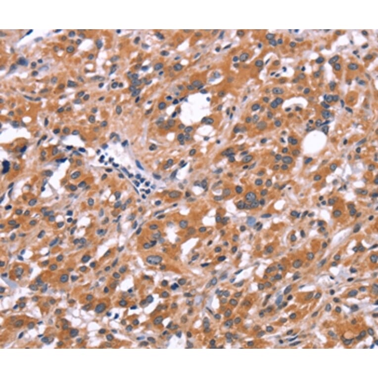 Immunohistochemistry - FDCSP Antibody from Signalway Antibody (37568) - Antibodies.com