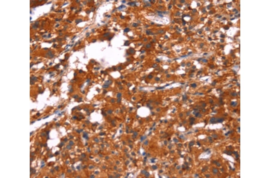 Immunohistochemistry - FEM1A Antibody from Signalway Antibody (37570) - Antibodies.com