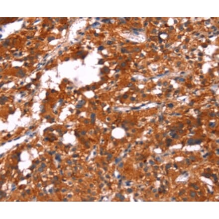 Immunohistochemistry - FEM1A Antibody from Signalway Antibody (37570) - Antibodies.com