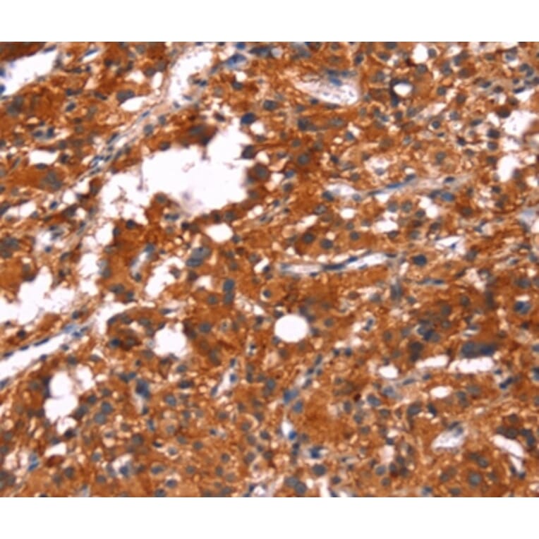 Immunohistochemistry - FEM1A Antibody from Signalway Antibody (37570) - Antibodies.com