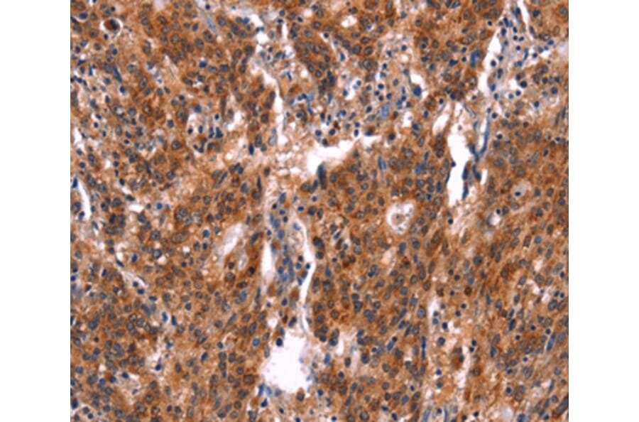 Immunohistochemistry - FEM1A Antibody from Signalway Antibody (37570) - Antibodies.com