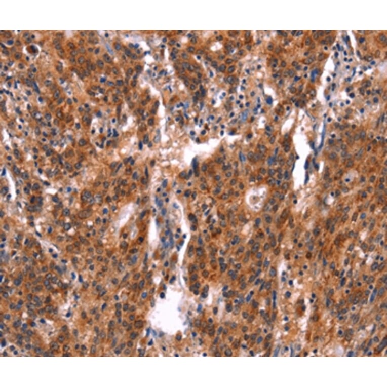 Immunohistochemistry - FEM1A Antibody from Signalway Antibody (37570) - Antibodies.com