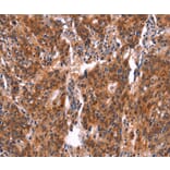 Immunohistochemistry - FEM1A Antibody from Signalway Antibody (37570) - Antibodies.com