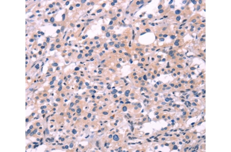 Immunohistochemistry - FGF16 Antibody from Signalway Antibody (37571) - Antibodies.com