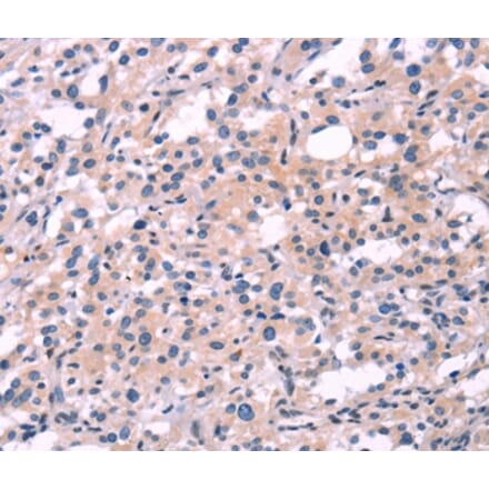Immunohistochemistry - FGF16 Antibody from Signalway Antibody (37571) - Antibodies.com