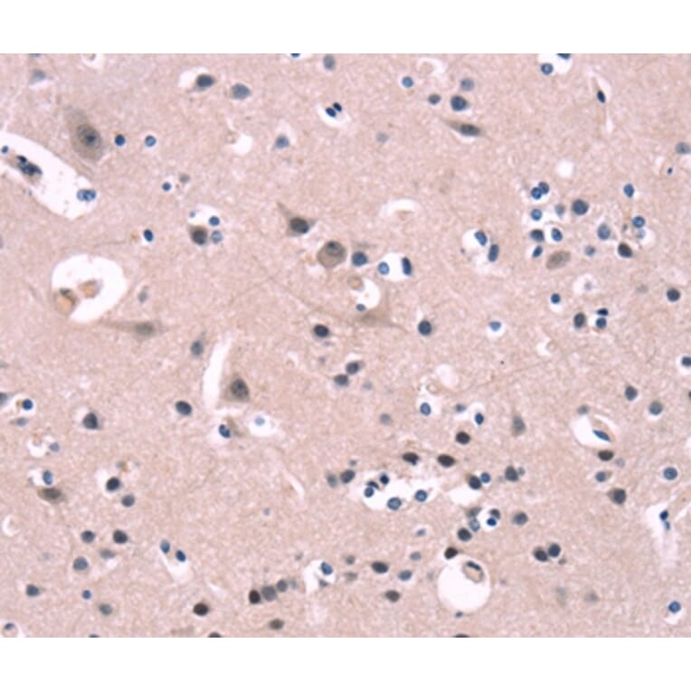 Immunohistochemistry - FGF16 Antibody from Signalway Antibody (37571) - Antibodies.com