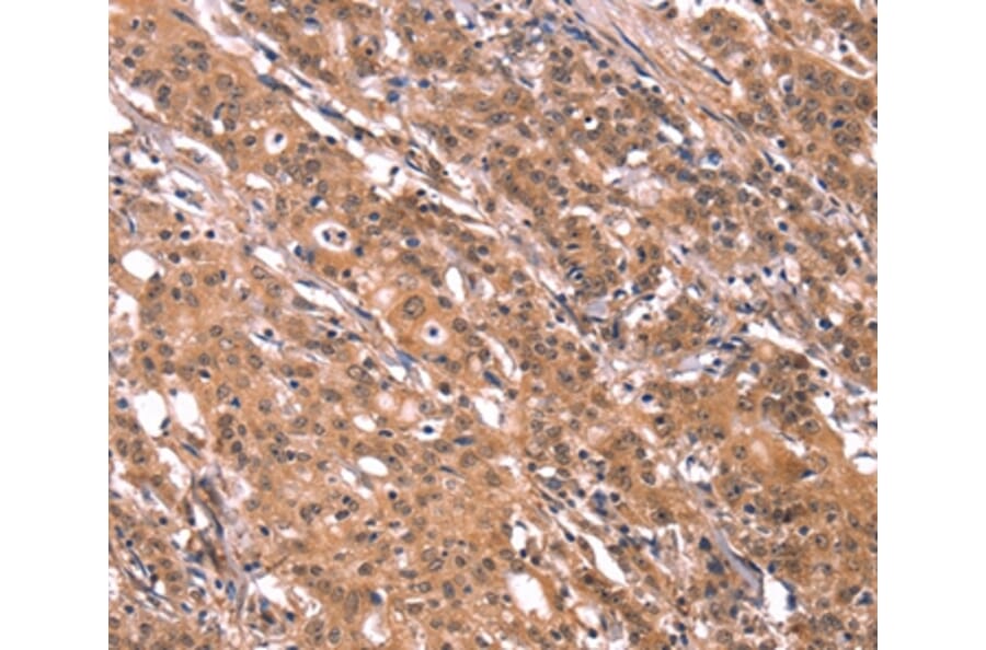 Immunohistochemistry - FGF22 Antibody from Signalway Antibody (37572) - Antibodies.com