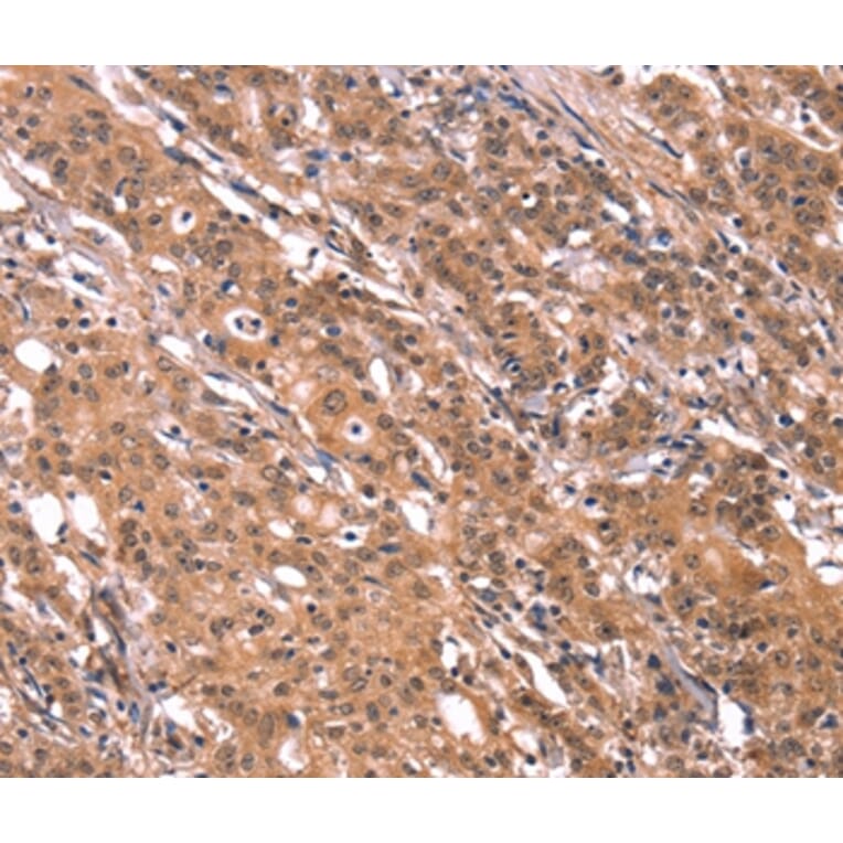 Immunohistochemistry - FGF22 Antibody from Signalway Antibody (37572) - Antibodies.com