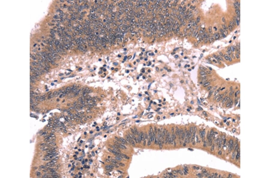 Immunohistochemistry - FGF22 Antibody from Signalway Antibody (37572) - Antibodies.com