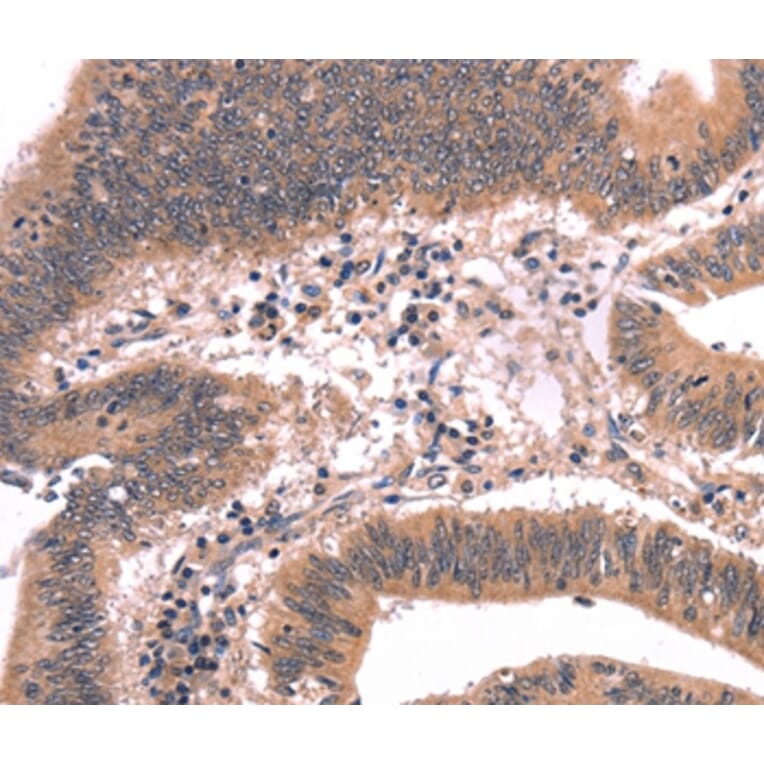 Immunohistochemistry - FGF22 Antibody from Signalway Antibody (37572) - Antibodies.com