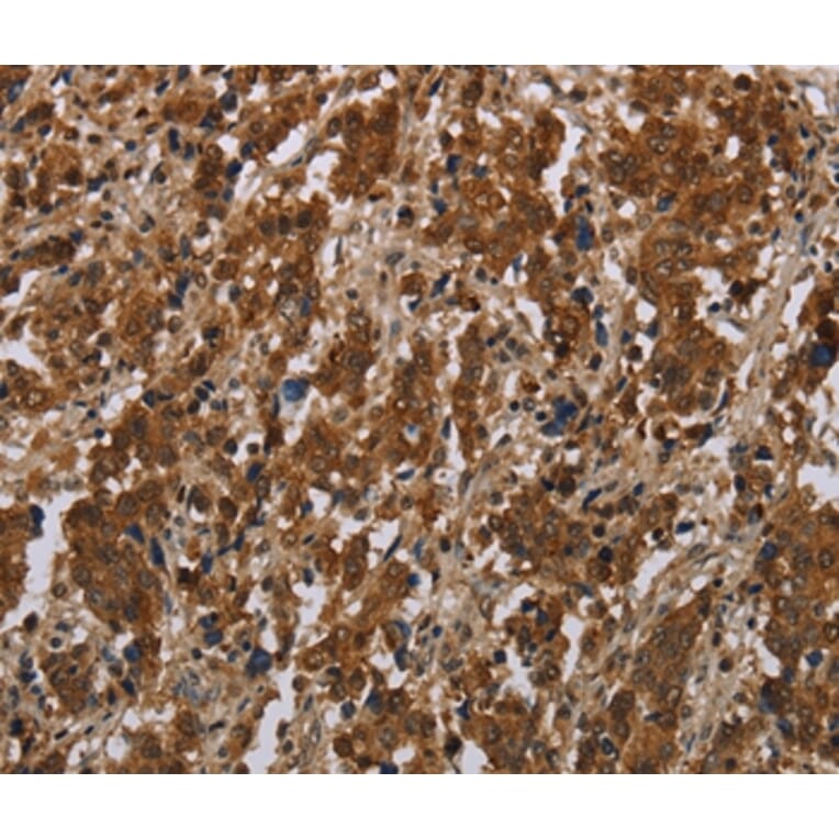 Immunohistochemistry - FGF20 Antibody from Signalway Antibody (37573) - Antibodies.com