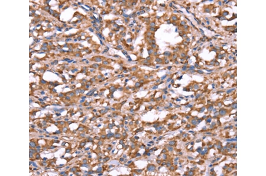 Immunohistochemistry - SPAST Antibody from Signalway Antibody (37577) - Antibodies.com