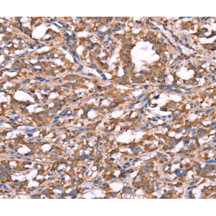 Immunohistochemistry - SPAST Antibody from Signalway Antibody (37577) - Antibodies.com