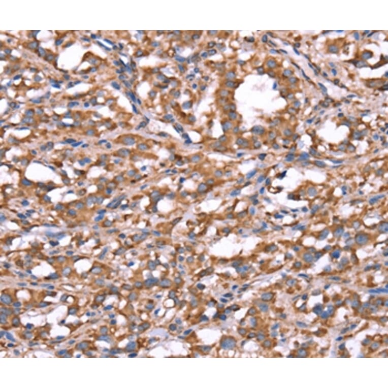 Immunohistochemistry - SPAST Antibody from Signalway Antibody (37577) - Antibodies.com