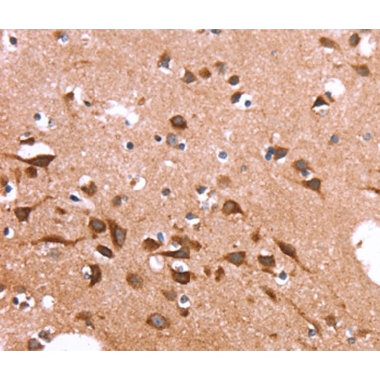 Immunohistochemistry - SPAST Antibody from Signalway Antibody (37577) - Antibodies.com
