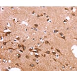 Immunohistochemistry - SPAST Antibody from Signalway Antibody (37577) - Antibodies.com