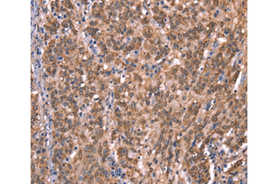 Immunohistochemistry - GCSAM Antibody from Signalway Antibody (37588) - Antibodies.com