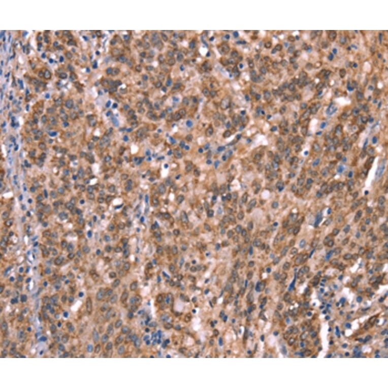 Immunohistochemistry - GCSAM Antibody from Signalway Antibody (37588) - Antibodies.com