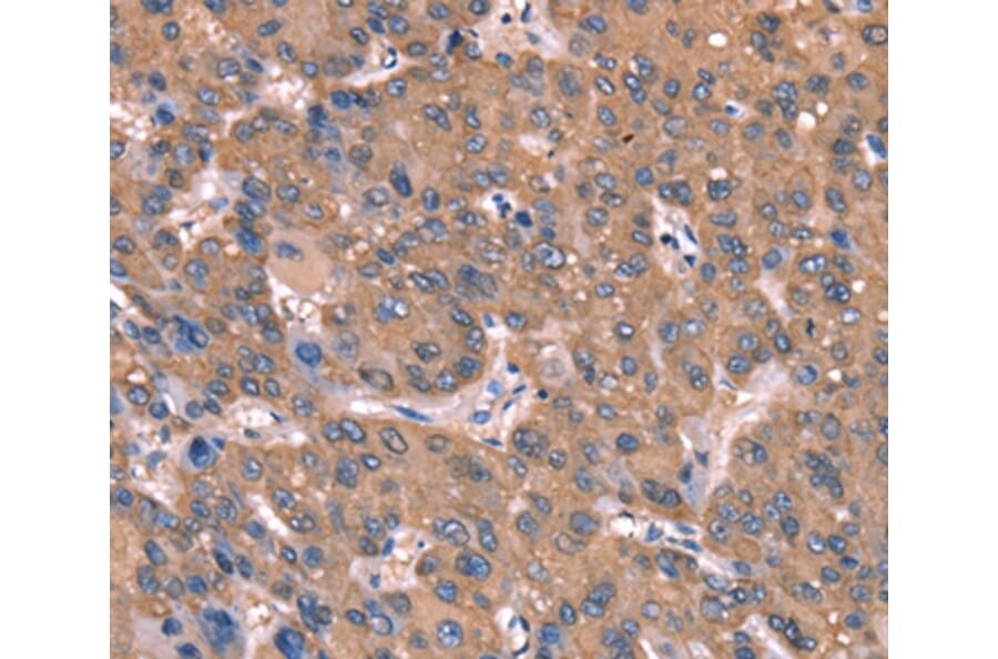 Immunohistochemistry - GCSAM Antibody from Signalway Antibody (37588) - Antibodies.com