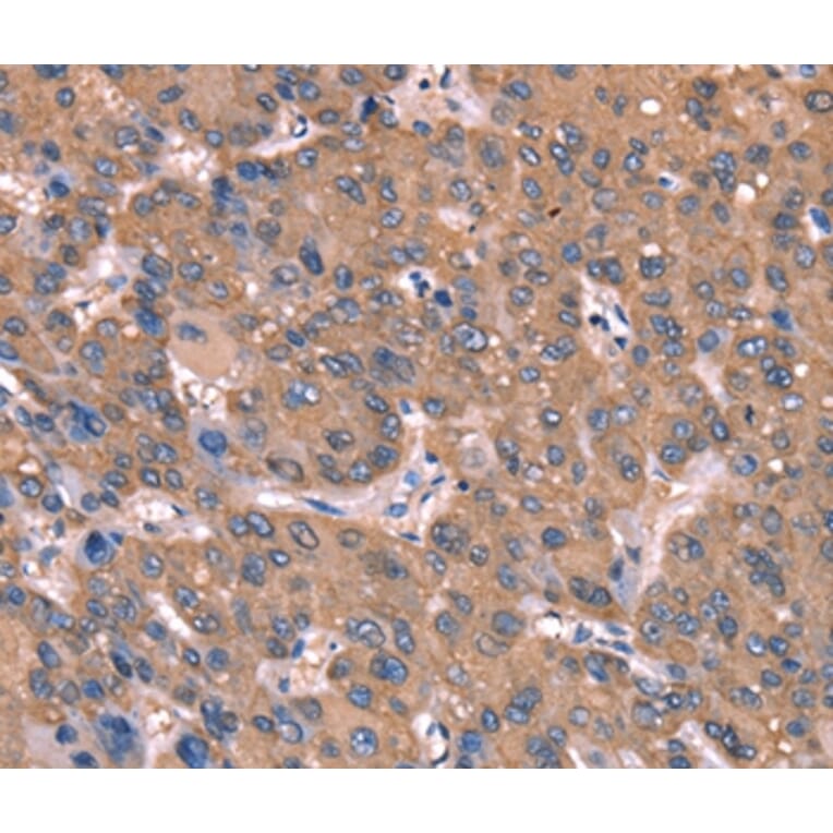 Immunohistochemistry - GCSAM Antibody from Signalway Antibody (37588) - Antibodies.com