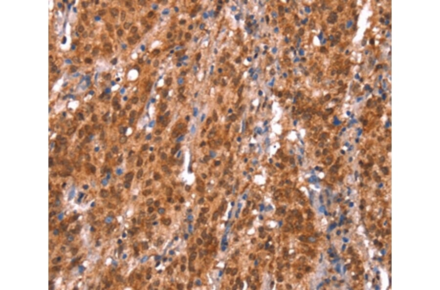 Immunohistochemistry - KCNJ6 Antibody from Signalway Antibody (37593) - Antibodies.com