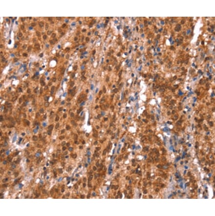 Immunohistochemistry - KCNJ6 Antibody from Signalway Antibody (37593) - Antibodies.com