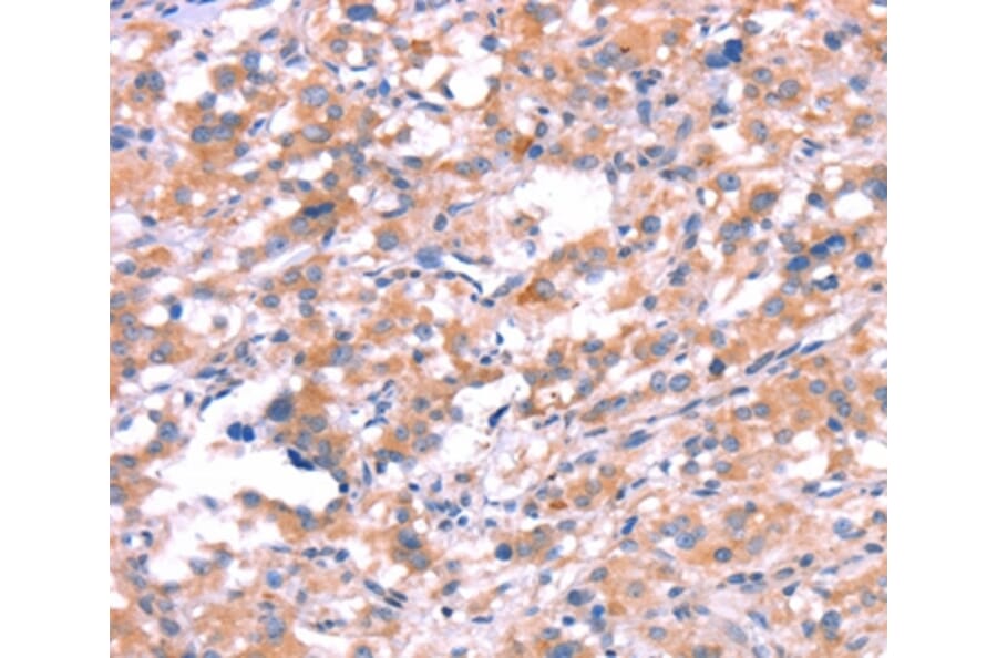 Immunohistochemistry - KCNJ6 Antibody from Signalway Antibody (37593) - Antibodies.com