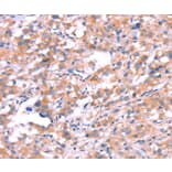 Immunohistochemistry - KCNJ6 Antibody from Signalway Antibody (37593) - Antibodies.com